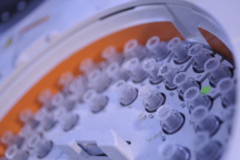 Mass Spectrometry Unit image